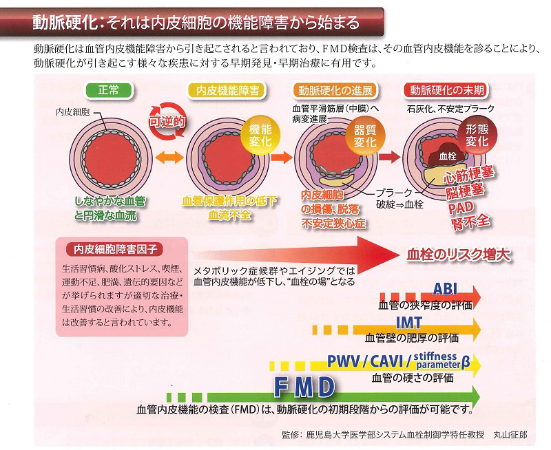 動脈硬化：それは内皮細胞の機能障害から始まる